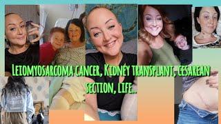 It's been tough, it's been beautiful! - Leiomyosarcoma terminal cancer & kidney transplant recipient