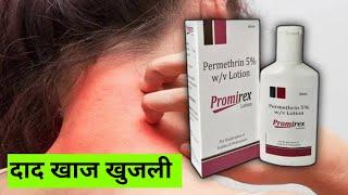 Premethrin 5% w/v Lotion | Skin Allergy | Fungal Infection | Medical Gyan