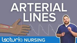 Arterial Lines: Placement Locations & Line Pressure Monitoring | Lecturio Critical Care Nursing