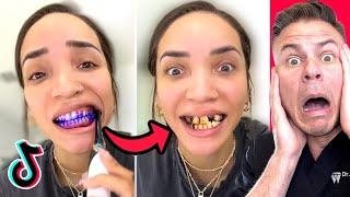 These TikToks Trends Will RUIN Your Teeth!