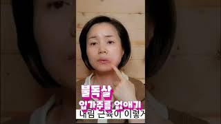 불독살 입가주름 없애는법 #입가주름없애기 #마리오네트주름 #입가처짐 #처진입꼬리올리기