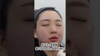 팔자주름 가장 자연스럽게 해결하는 방법 보여드릴께요 #쥬베룩볼륨