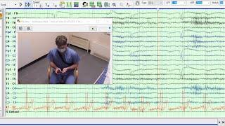 Electroencephalogram