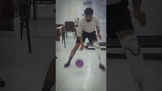 Playing with artificial limbs after amputation   #ahmedabad #legprosthesis #prostheticleg