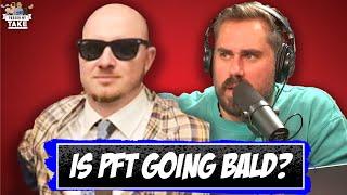 BREAKING: PFT Commenter Is Going Bald