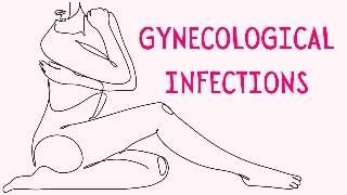 The THREE most common Gynaecological Infections in Female