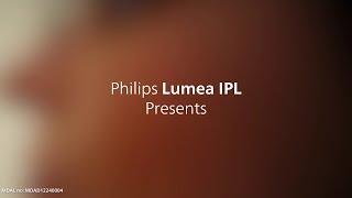 Easy way to get 12 months of smooth skin | Philips Lumea