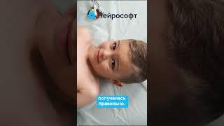 Наложение ЭКГ-электродов #ЭКГ #Нейрософт