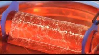 Engineered vaginas grown in women for the first time