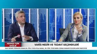 Herkes İçin Sağlık - Varis Nedir ve Tedavi Seçenekleri