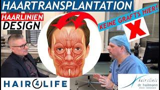 HaartransplantationNatürliche vs. künstliche Haarlinie und Wichtigkeit der mimischen Muskulatur