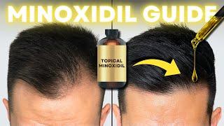 How to Regrow Hair with Minoxidil for BEST Results (Complete Guide)