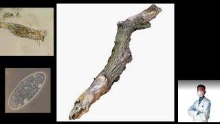 Finding microbes in rotten wood under microscope... Various organisms are here .By Anmol Samsuhang