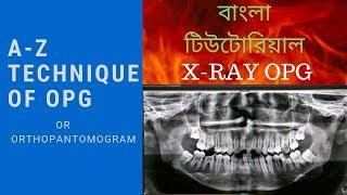 ORTHOPANTOMOGRAM(OPG) ,DENTAL X RAY OPG (Ep-04)