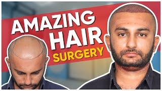 Hair Transplant in Ahmedabad | Best Results & Cost of Hair Transplant in Ahmedabad