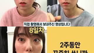 [파파레서피] 프로폴리스 95% 진짜 프로폴리스 앰플 찾기 