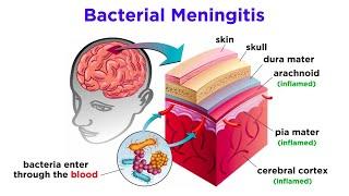 Brain Damage and Neuroplasticity