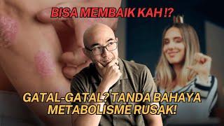 GATAL GATAL ? TANDA BAHAYA METABOLISME KALIAN RUSAK !