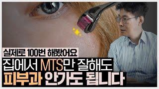 실제로 100번했던 셀프피부관리? ㅣ MTS 들어보신 분들 주목ㅣㅣ6분 MTS 핵심 영상