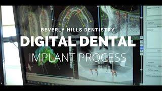 Digital Dental Implant Process | Beverly Hills Dentistry