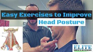 Easy Exercises To Improve Head Posture | Chesterfield Chiropractor