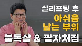 실리프팅 하고 나서 유독 아쉬움이 남는 부위? 그 이유는 뭘까? | 심술보 마리오넷 주름, 팔자주름