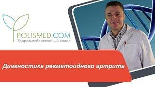 Диагностика ревматоидного артрита (РА): анализы крови и мочи, ревматоидный фактор, тест на АЦЦП