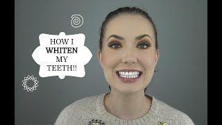 HOW TO WHITEN YOUR TEETH! (5 TRICKS)