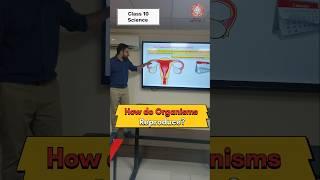 Day - 117 Class 10 @ A  J  PATEL INSTITUTE #education #class10