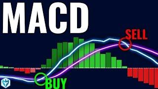 How I Nailed Trading with the MACD Indicator (Step-by-Step Guide)