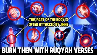 RUQYAH destroys the jinn that live in the nose and head | Maged Aldaoos ماجد الدعوس