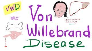 Von Willebrand Disease (vWD) - The Most COMPREHENSIVE Explanation!  -  Hematology