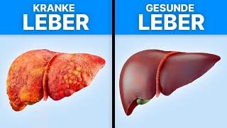 4 Lebensmittel, die deine Leber entgiften!