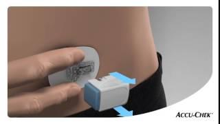 Accu-Chek Insight Flex Trainingsvideo