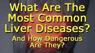 What Are The Most Common Liver Diseases - And How Dangerous Are They?
