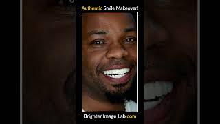 How to Get a Perfect Smile | Lab Direct Dental Solution
