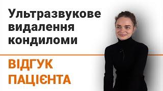 Ультразвукове видалення кондиломи - відгук пацієнтки клініки Добрий Прогноз