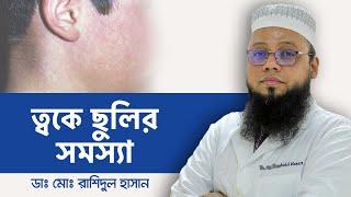 ত্বকের দাগ দূর করার উপায় | How To Remove Spots From Face | ত্বকের ছুলি দূর করার উপায়