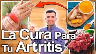 Cómo Eliminar La Artritis O Reumantismo Y Regenerar Tus Articulaciones