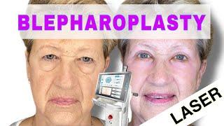 Blepharoplasty Eyelid Surgery | Droopy Eyes | Eye And Brow Lift - Tampa Bay , Clearwater Florida