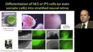 IRP Neuroscience Webinar (Part 3) - Anand Swaroop, NIH Scientist