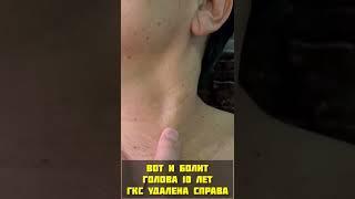 Удалили мышцу и заболела голова