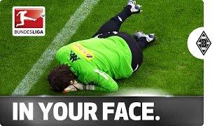 Ouch! Headache Hero Yann Sommer Takes One in the Face