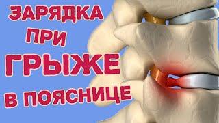 Зарядка при грыже поясничного отдела. Упражнения ЛФК при экструзии и протрузии.