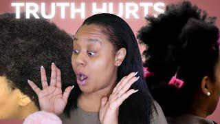 WHY UR HAIR WONT GROW/RETAIN LENGTH‼️YOUNG BW R BALDING PART 2 2024‼️ ​⁠@IamCynDoll