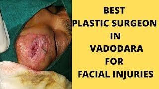 best plastic surgeon in vadodara / plastic surgery / facial injury / plastic surgery in india