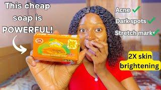 How to use cheap Asantee soap to brighten your skin & clear spot | How to identify fake Asantee soap