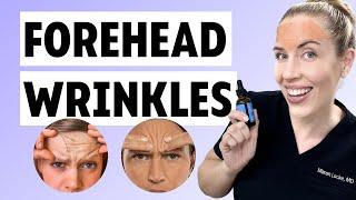 Improve Forehead Wrinkles Without Botox | 3 At-home Tips!