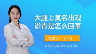 大腿上莫名出现淤青是怎么回事？