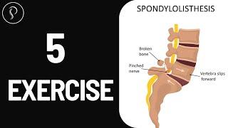 Top 5 Exercises for Spondylolisthesis | Relieve Pain & Strengthen Your Spine | dr. harish grover